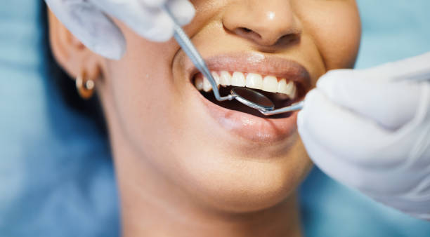 Professional Emergency Dental Service in CO